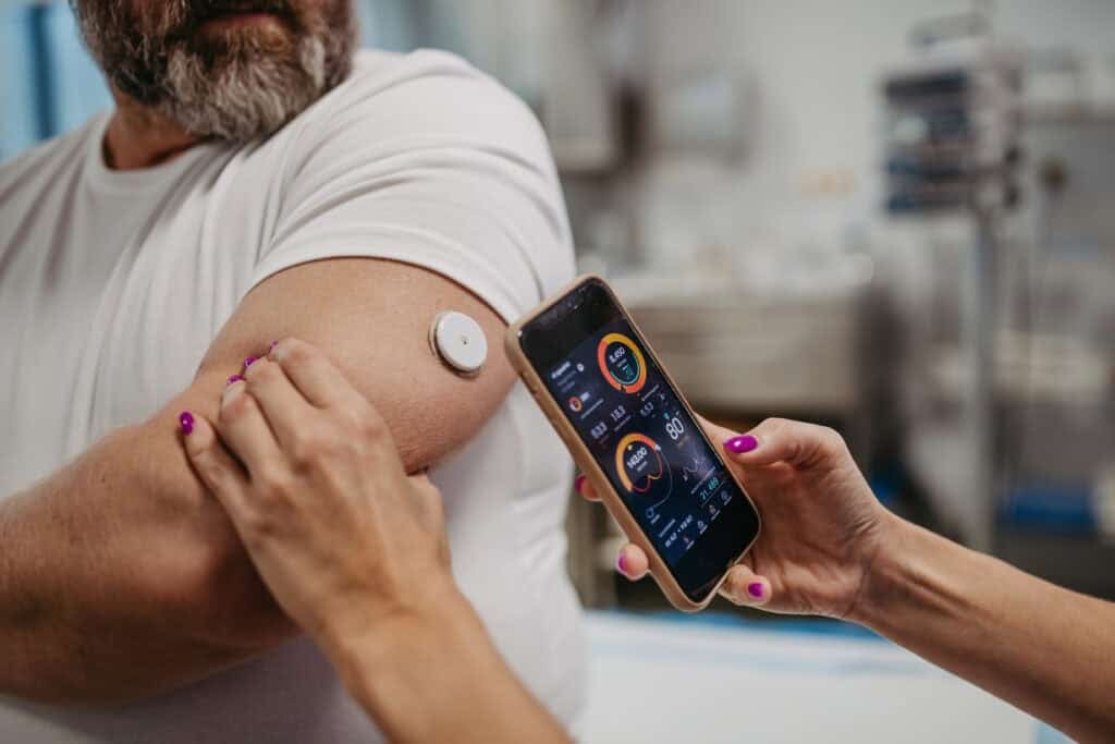 Clinical Team connecting continuous glucose monitor with smartphone, to check blood sugar level in real time. Overweight man is at risk of developing type 2 diabetes. 